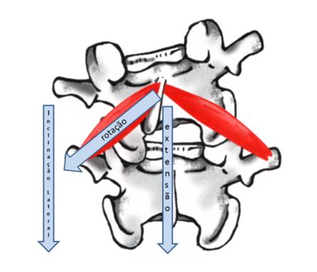 Os 5 lados da escoliose. Lado 4. cranio caudal da escoliose