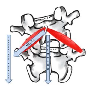 escoliose-4-dimesao-cranio-caudal escoliose-4-dimesao-cranio-caudal